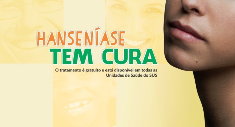 Saúde promove atividade de prevenção da hanseníase – Prefeitura Municipal  de Ubatuba