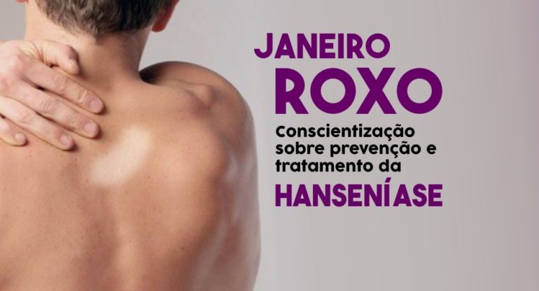 Janeiro Roxo” alerta para o diagnóstico e tratamento da hanseníase