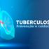 Tuberculose