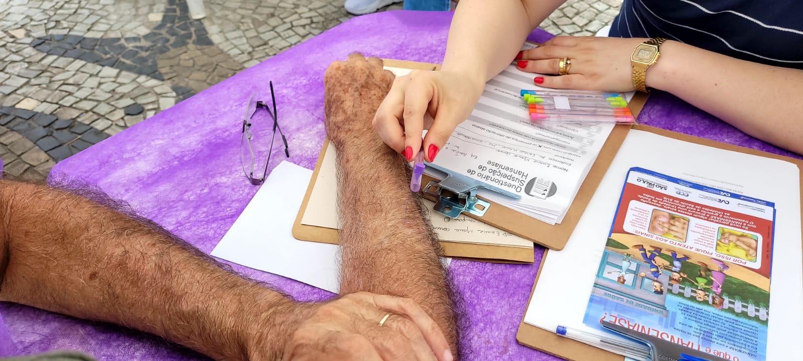 Saúde promove atividade de prevenção da hanseníase – Prefeitura Municipal  de Ubatuba