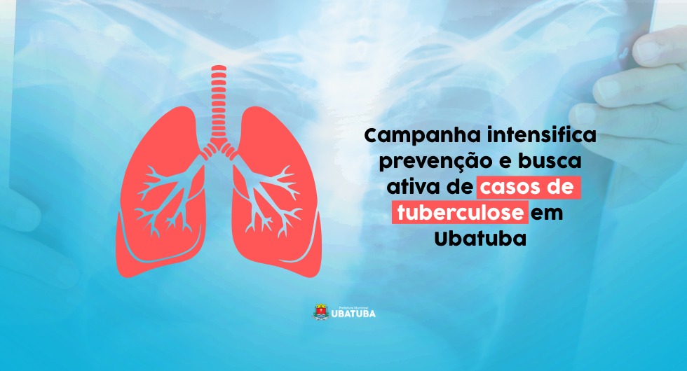 Campanha de intensificação de casos de tuberculose começa hoje